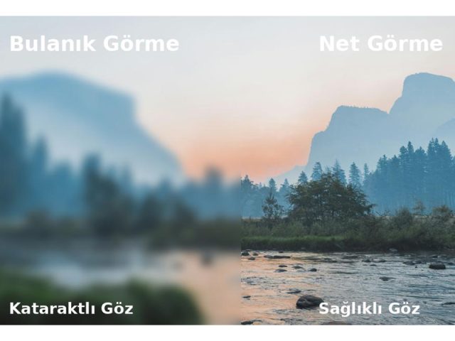 Kataraktın Belirtileri ve Tanı Yöntemleri